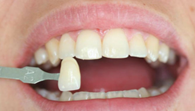 odontoiatria-estetica-dentista-casotto-niguarda-milano