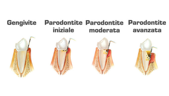 parodontologia-endodonzia-dentista-casotto-niguarda-milano